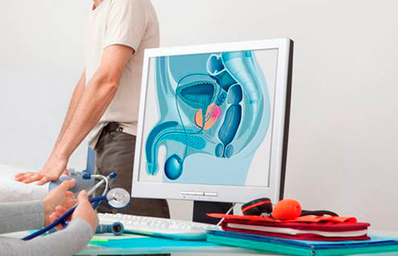 flujometria. Urología Ciudad Real