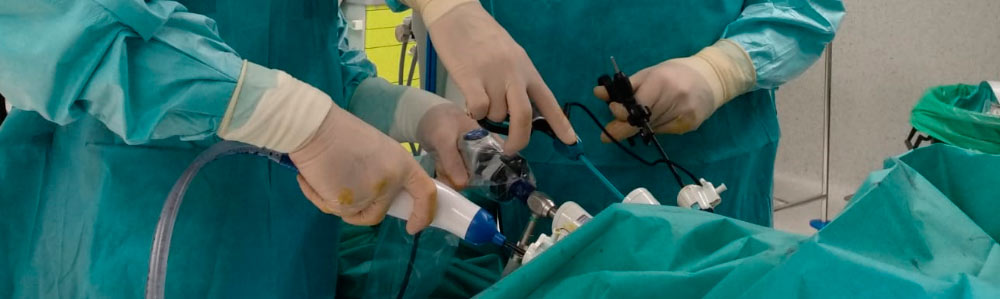 Cirugía laparoscópica. Urología Ciudad Real